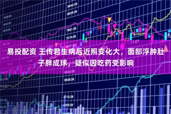 易投配资 王传君生病后近照变化大，面部浮肿肚子胖成球，疑似因吃药受影响